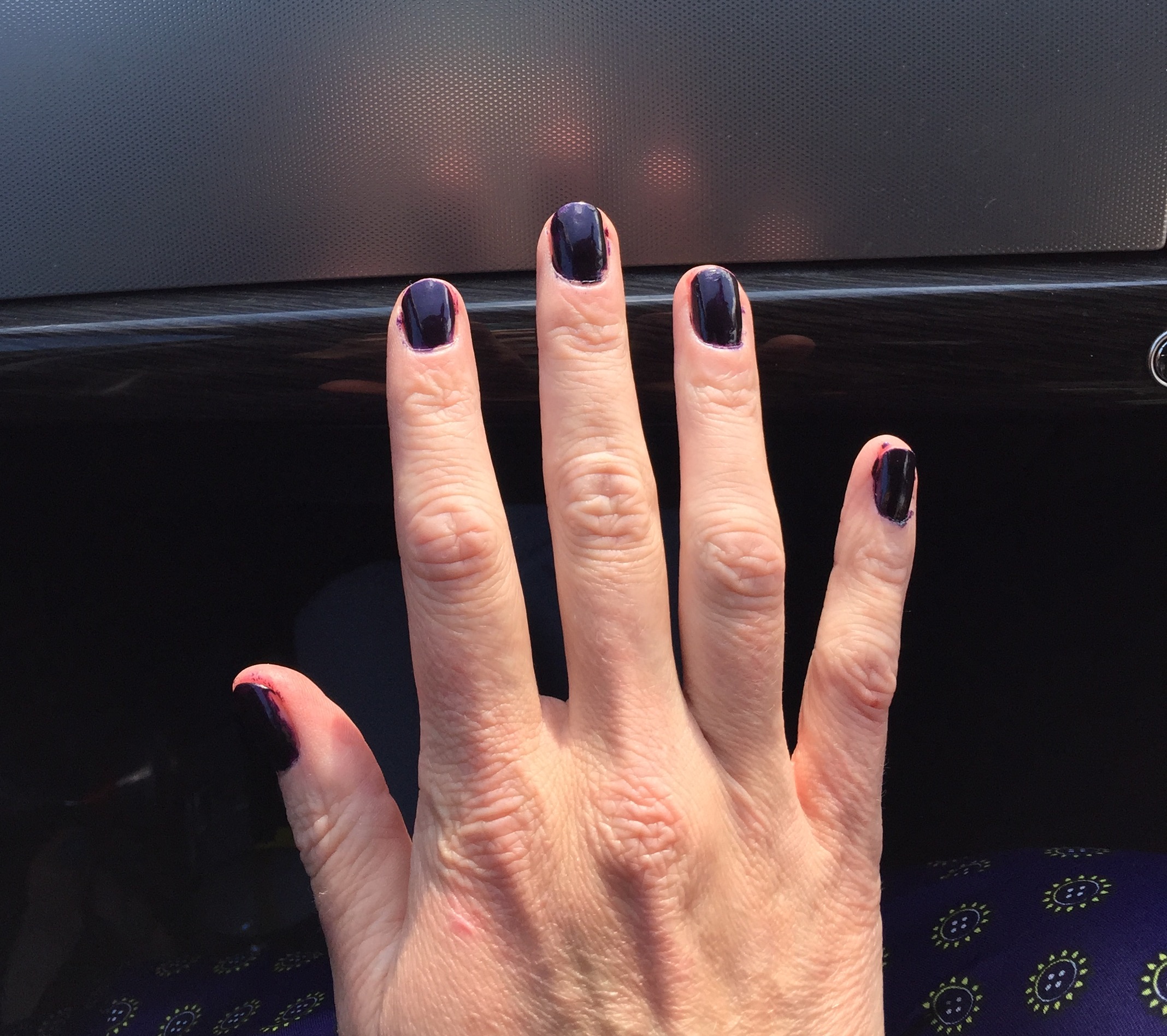 I Didn't Expect THAT: Chemo Nails – Frantic Shanti